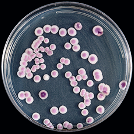 Round Candida auris organisms (colored pink, white, or purple) in a petri dish