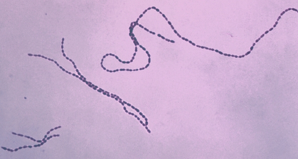 Purple-stained, beadlike chains of bacteria