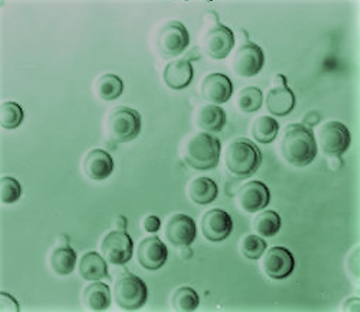 About two dozen round yeast cells stained green