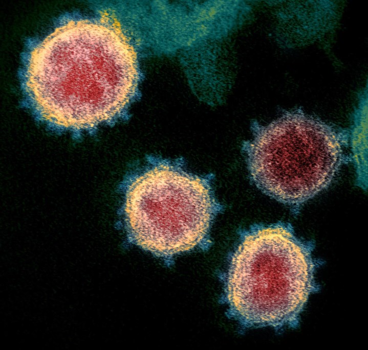 Four coronaviruses, colorized predominantly light red/pink, with each having a thin yellow circular border and bluish spur-shaped proteins protruding from the surface of each virus particle, on a black background