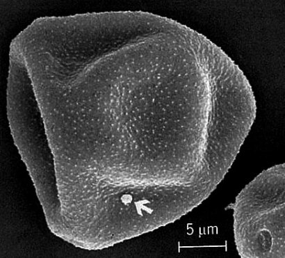 Black-and-white image of a roundish pollen grain with a dotlike orbicule indicated by a small arrow; scale bar = 5 Âµm