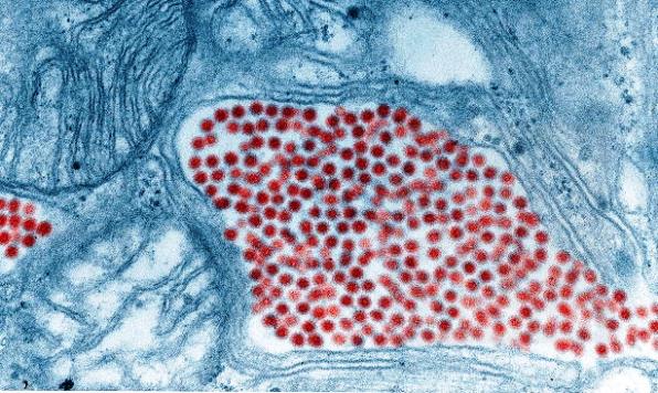 Transmission electron micrograph of numerous small, round, red-colorized virus particles; the rest of the image is colored blue
