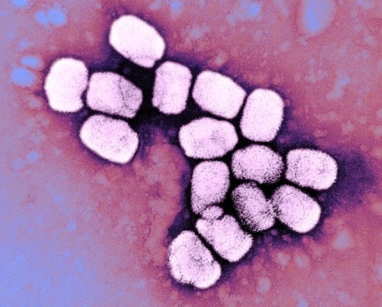 Brick-shaped smallpox viruses (on a purple background)