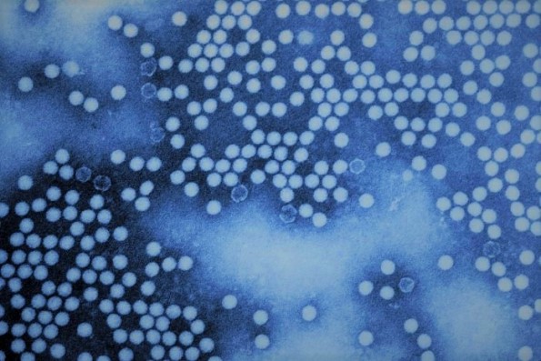 Blue-tinted image of numerous round virus particles
