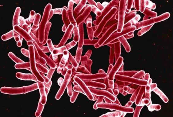 A cluster of red-colored, rod-shaped bacteria