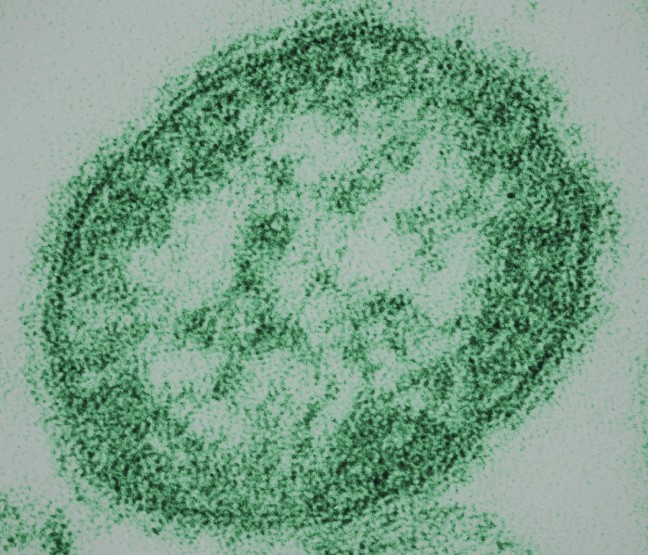 A single round virion (colorized green) of measles virus