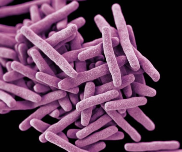 Rod-shaped Mycobacterium tuberculosis bacteria (colorized purple) on a black background
