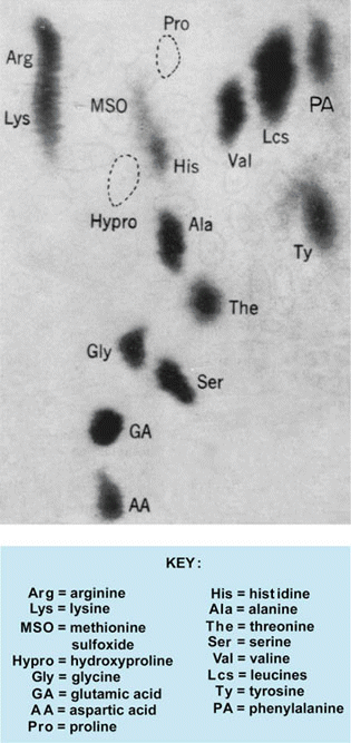 Black-and-white chromatogram of a protein; various amino acids are labeled, and a key lists the abbreviations used