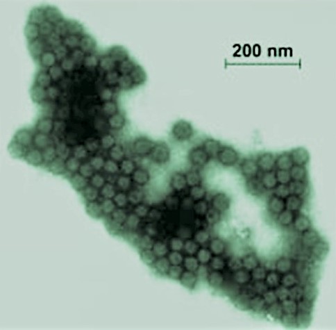 Green-tinted roundish virions; scale bar = 200 nm