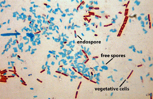 Photomicrograph of endospore staining, showing endospores, free spores, and vegetative cells