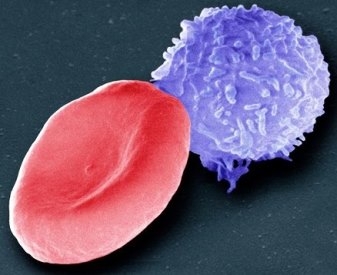 Image of a human red blood cell and a human white blood cell