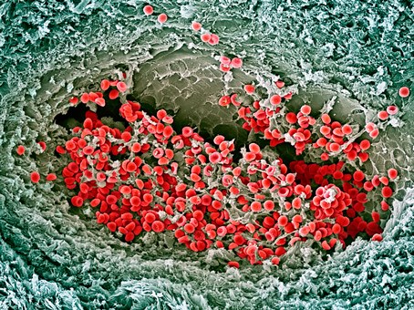 Image of blood clotting in an ovarian follicle