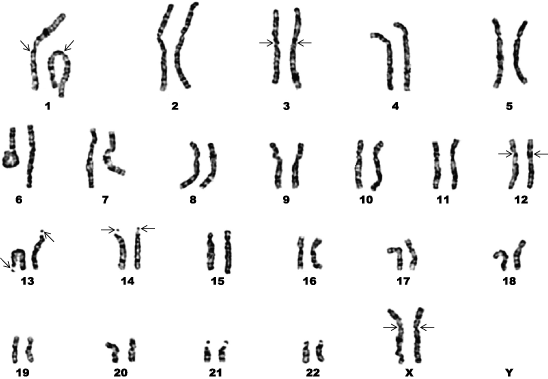 Diploid set of normal human female chromosomes that have been G-banded for identification
