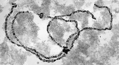 Black-and-white photo of Drosophila polytene chromosomes