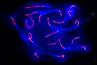 Immunofluorescent image of spread mouse SCs