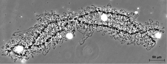 Black-and-white photo of lampbrush chromosomes