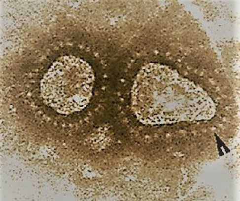 Two brown-colorized coronaviruses, which are roundish in shape
