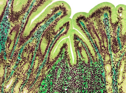 Colorized (green) light micrograph of the stomach lining