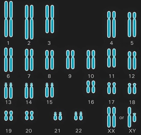 Digital illustration of 22 chromosomes plus the sex chromosomes (XX or XY)