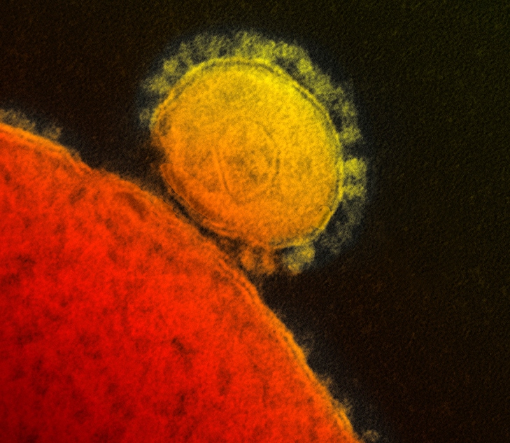 Yellow/orange-colorized image of a MERS coronavirus (with a crown of particles around it)