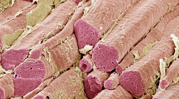 Close-up view of skeletal muscle fibers (colored reddish pink)