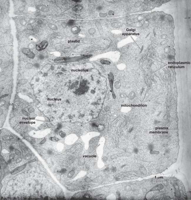 Black-and-white image of a root epidermal cell; various structures are labeled; scale bar = 1 μm