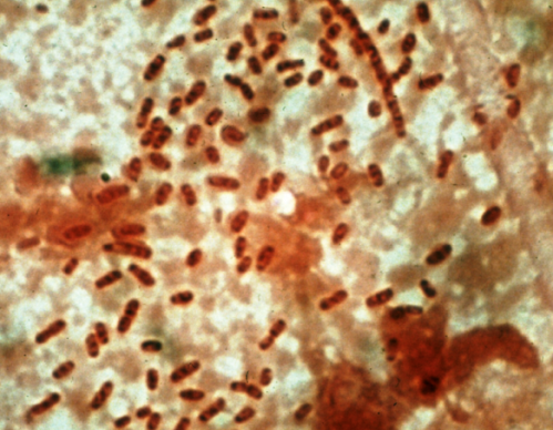 Brown-stained rod-shaped forms of Klebsiella bacteria