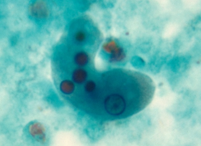 A blue-colored trophozoite with various internal organlles seen in its cytoplasm