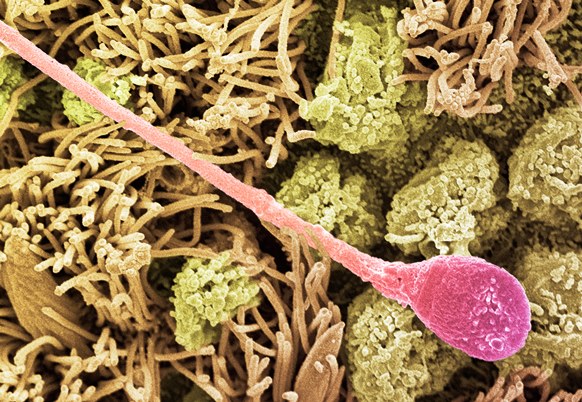 Colored SEM of a sperm cell (pink) among the tissue cells of a Fallopian tube (strandlike in appearance, and colored yellowish)