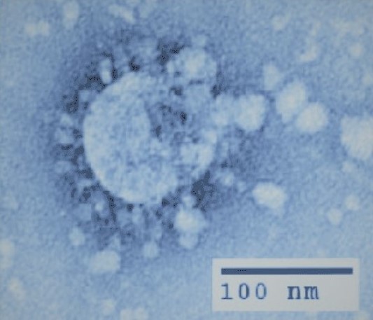 Image of a SARS coronavirus, with a crown of particles surrounding the virus; a scale bar = 100 nm is shown