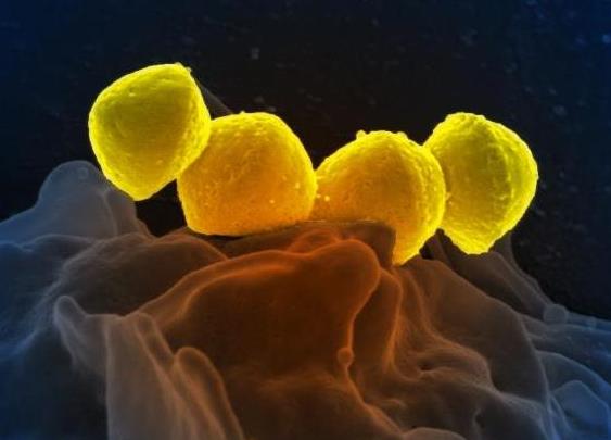 Four bacteria (colored yellow) attached to a bumpy area of a neutrophil (gray in color)