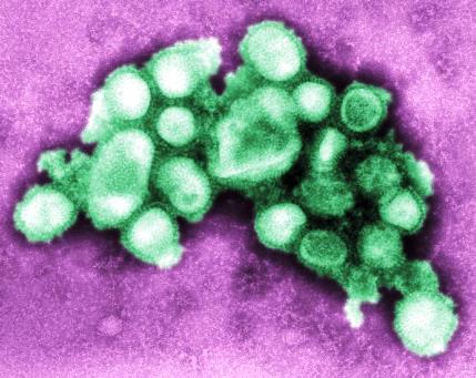 Colorized TEM of the swine flu virus