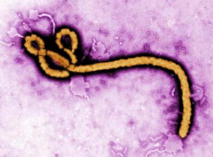 Colorized TEM of an Ebola virus virion