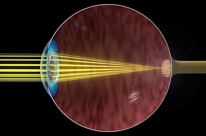 Illustration showing how light enters the eye and is focused on the retina, against a black background