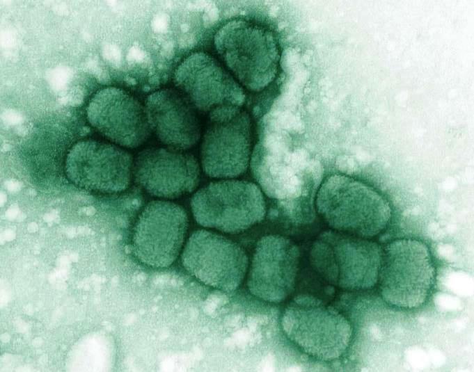 Green-colored, barrel-shaped smallpox viruses